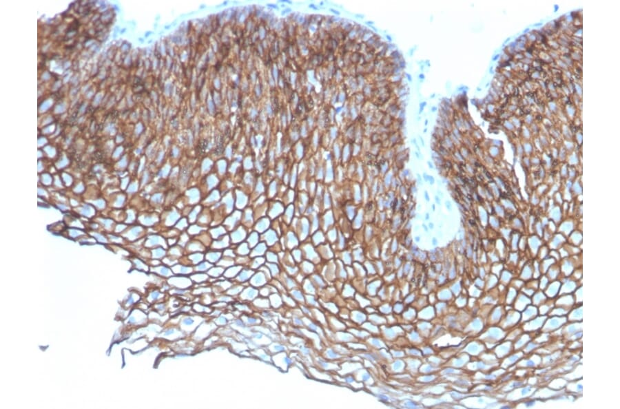 Immunohistochemistry - Anti-Desmoglein 3 Antibody [DSG3/2837] (A248377) - Antibodies.com
