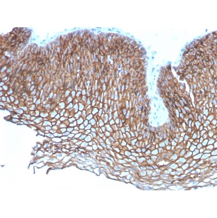 Immunohistochemistry - Anti-Desmoglein 3 Antibody [DSG3/2837] (A248377) - Antibodies.com