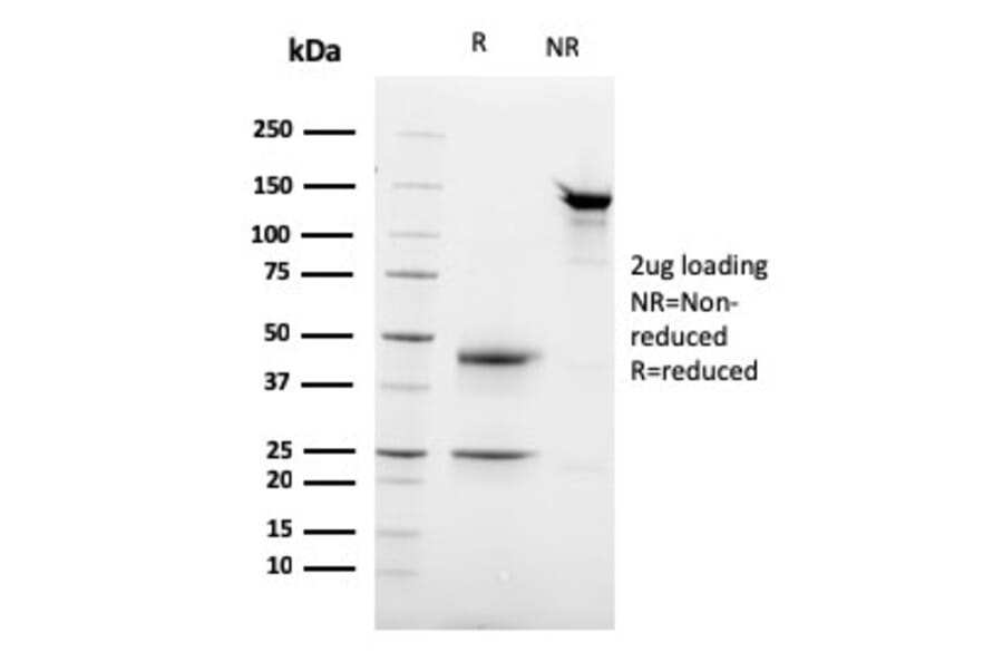 SDS-PAGE - Anti-Desmoglein 3 Antibody [DSG3/2837] (A248377) - Antibodies.com