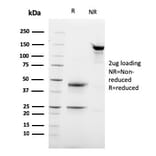 SDS-PAGE - Anti-Desmoglein 3 Antibody [DSG3/2837] (A248377) - Antibodies.com