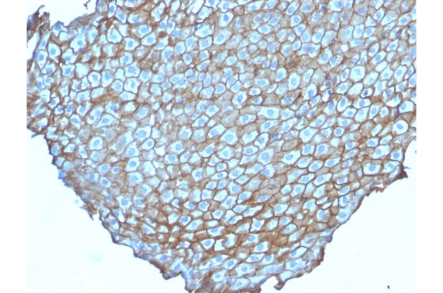 Immunohistochemistry - Anti-Desmoglein 3 Antibody [DSG3/2838] (A248378) - Antibodies.com