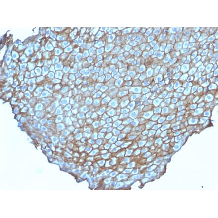 Immunohistochemistry - Anti-Desmoglein 3 Antibody [DSG3/2838] (A248378) - Antibodies.com