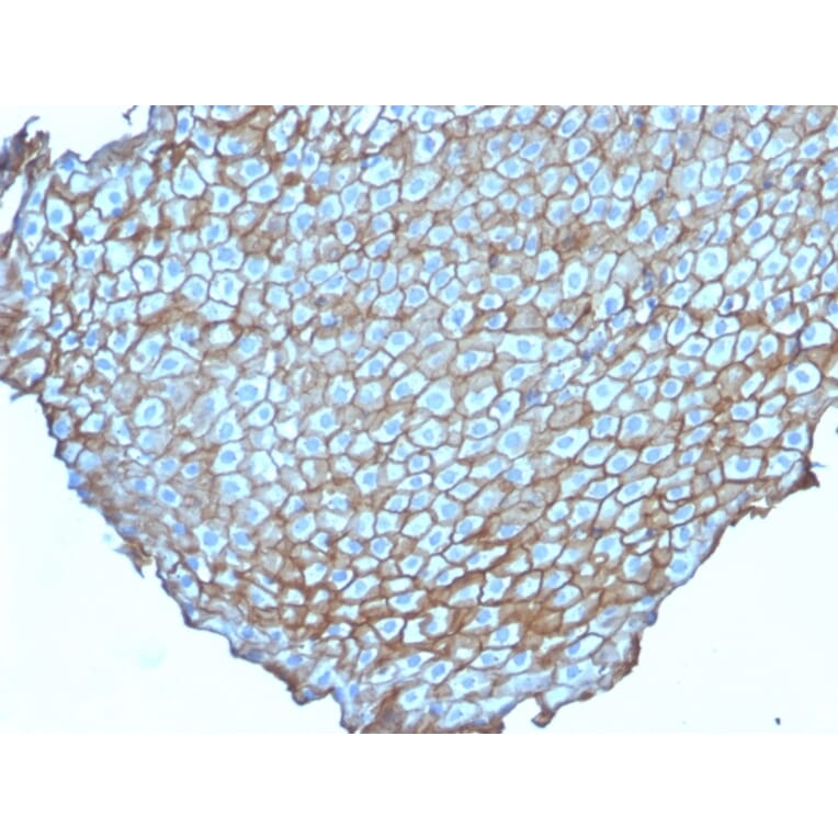 Immunohistochemistry - Anti-Desmoglein 3 Antibody [DSG3/2838] (A248378) - Antibodies.com