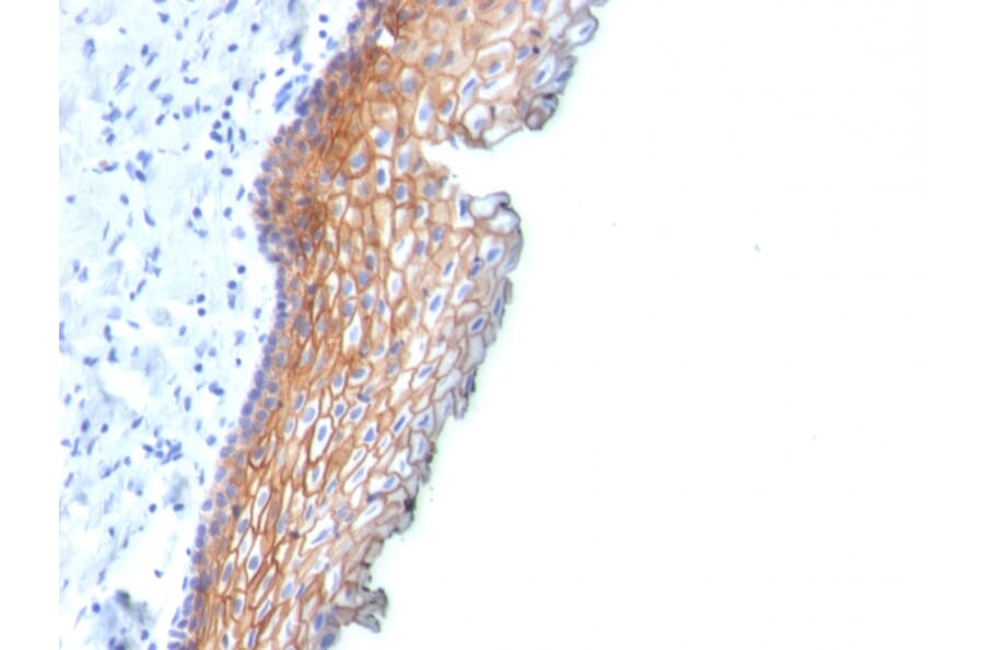 Immunohistochemistry - Anti-Desmoglein 3 Antibody [DSG3/2838] (A248378) - Antibodies.com