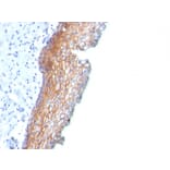 Immunohistochemistry - Anti-Desmoglein 3 Antibody [DSG3/2838] (A248378) - Antibodies.com