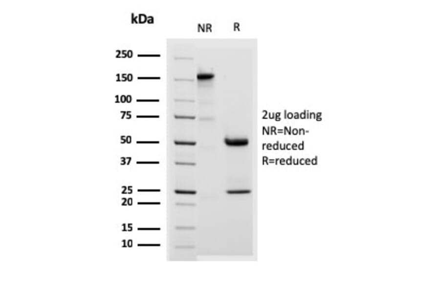 SDS-PAGE - Anti-Desmoglein 3 Antibody [DSG3/2838] (A248378) - Antibodies.com