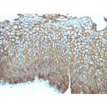 Immunohistochemistry - Anti-Desmoglein 3 Antibody [DSG3/2839] (A248379) - Antibodies.com