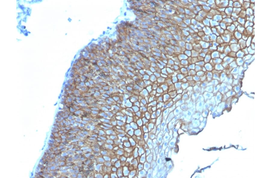 Immunohistochemistry - Anti-Desmoglein 3 Antibody [DSG3/2839] (A248379) - Antibodies.com