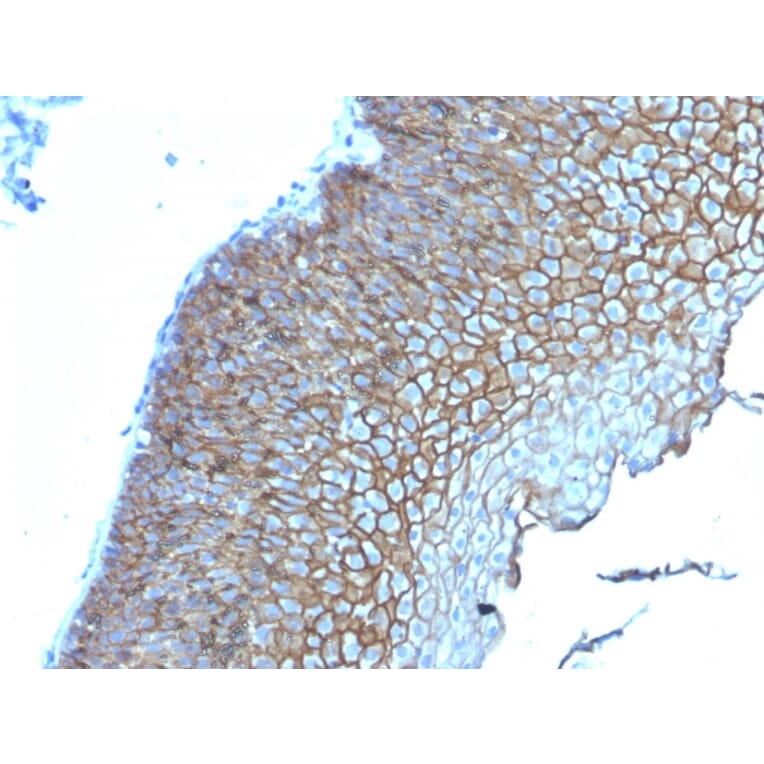 Immunohistochemistry - Anti-Desmoglein 3 Antibody [DSG3/2839] (A248379) - Antibodies.com
