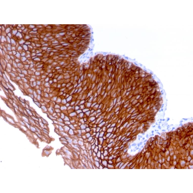 Immunohistochemistry - Anti-Desmoglein 3 Antibody [DSG3/2839] (A248379) - Antibodies.com