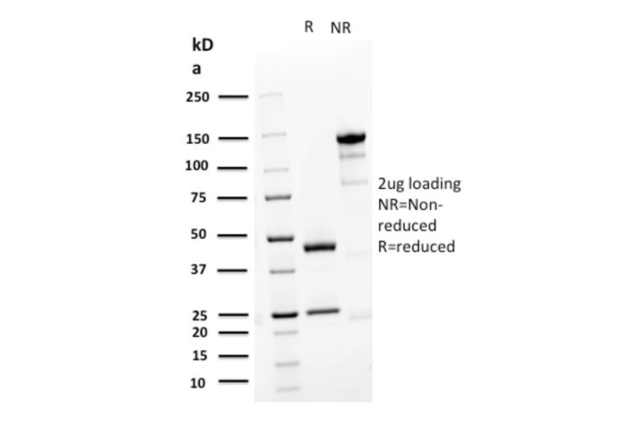 SDS-PAGE - Anti-Desmoglein 3 Antibody [DSG3/2839] (A248379) - Antibodies.com