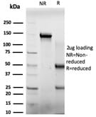 SDS-PAGE analysis of Anti-E4F1 Antibody [PCRP-E4F1-2D1] under non-reduced and reduced conditions; showing intact IgG and intact heavy and light chains, respectively. SDS-PAGE analysis confirms the integrity and purity of the antibody.