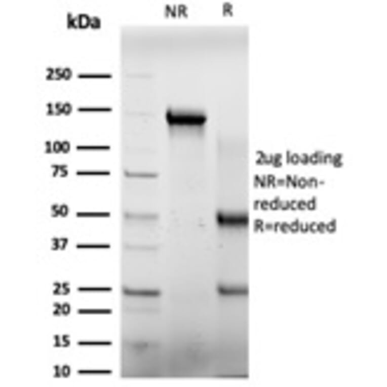 SDS-PAGE - Anti-E4F1 Antibody [PCRP-E4F1-2D1] (A248381) - Antibodies.com