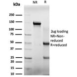 SDS-PAGE - Anti-E4F1 Antibody [PCRP-E4F1-2D1] (A248381) - Antibodies.com