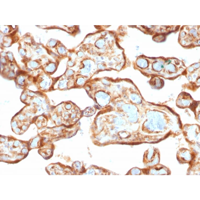 Immunohistochemistry - Anti-Thymidine Phosphorylase Antibody [P-GF.44C] (A248381) - Antibodies.com