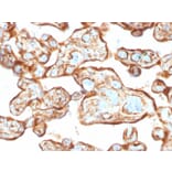 Immunohistochemistry - Anti-Thymidine Phosphorylase Antibody [P-GF.44C] (A248381) - Antibodies.com