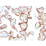 Immunohistochemistry - Anti-Thymidine Phosphorylase Antibody [SPM322] (A248382) - Antibodies.com