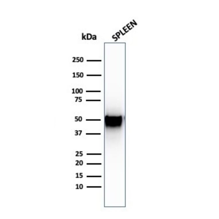 Western Blot - Anti-Thymidine Phosphorylase Antibody [SPM322] (A248383) - Antibodies.com