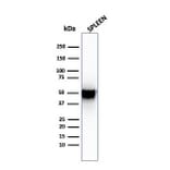 Western Blot - Anti-Thymidine Phosphorylase Antibody [SPM322] (A248383) - Antibodies.com