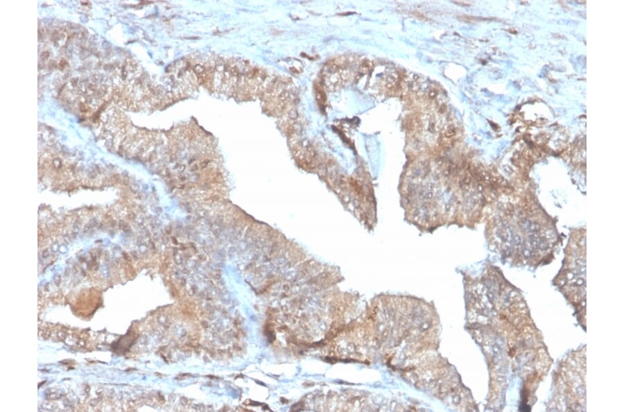 Immunohistochemistry - Anti-Thymidine Phosphorylase Antibody [rTYMP/3444] (A248383) - Antibodies.com