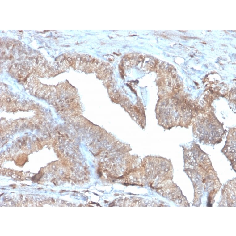 Immunohistochemistry - Anti-Thymidine Phosphorylase Antibody [rTYMP/3444] (A248383) - Antibodies.com