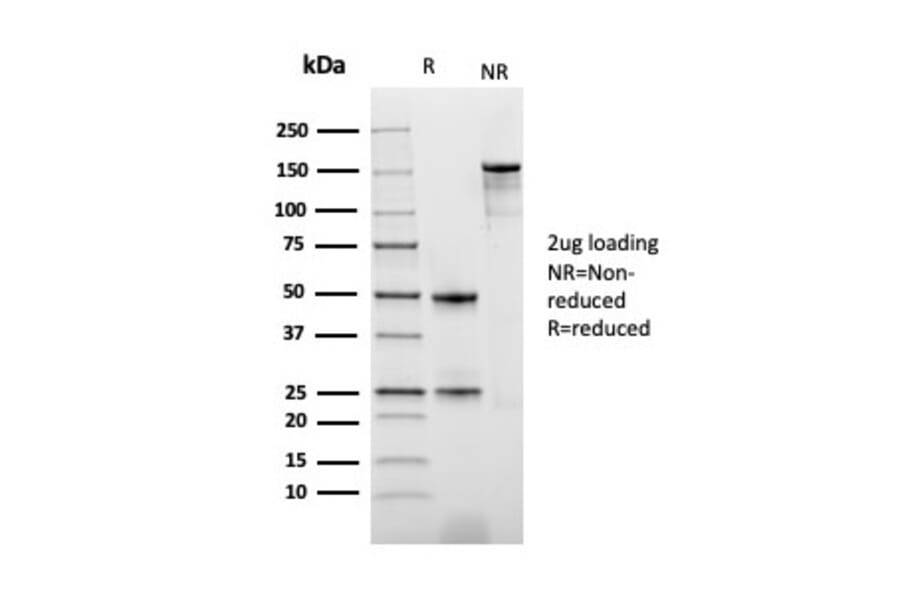SDS-PAGE - Anti-Thymidine Phosphorylase Antibody [rTYMP/3444] (A248384) - Antibodies.com