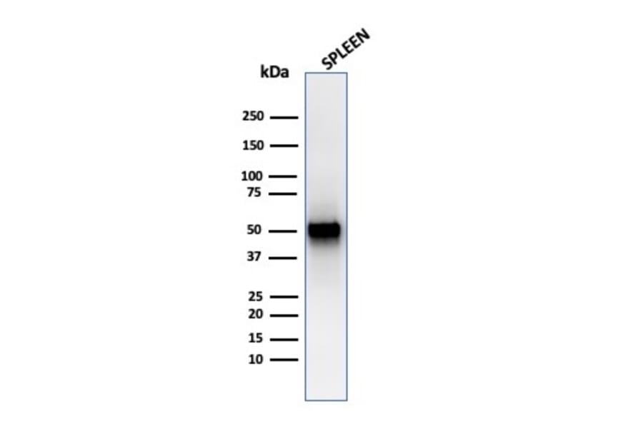 Western Blot - Anti-Thymidine Phosphorylase Antibody [rTYMP/3444] (A248384) - Antibodies.com