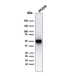 Western Blot - Anti-Thymidine Phosphorylase Antibody [rTYMP/3444] (A248384) - Antibodies.com