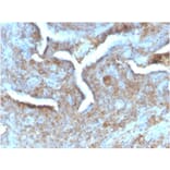 Immunohistochemistry - Anti-Thymidine Phosphorylase Antibody [TYMP/2890R] (A248384) - Antibodies.com