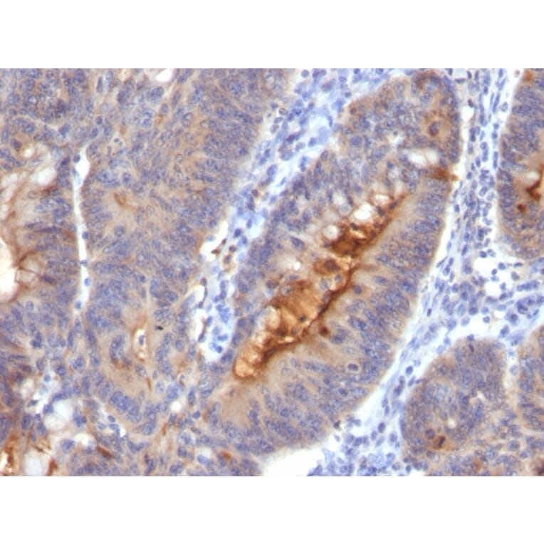 Immunohistochemistry - Anti-ECM1 Antibody [SC05] (A248385) - Antibodies.com