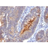 Immunohistochemistry - Anti-ECM1 Antibody [SC05] (A248385) - Antibodies.com