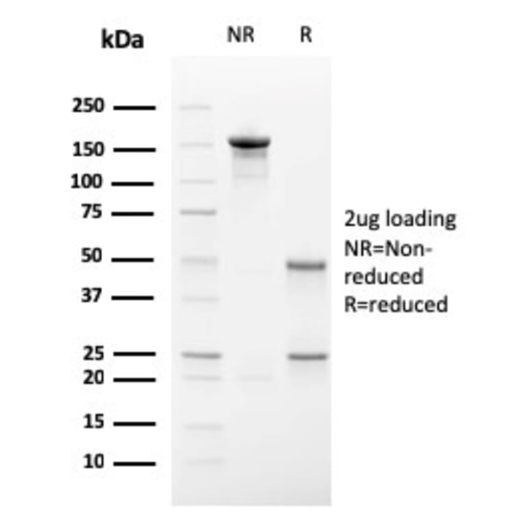 SDS-PAGE - Anti-ECM1 Antibody [SC05] (A248386) - Antibodies.com