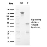 SDS-PAGE - Anti-ECM1 Antibody [SC05] (A248386) - Antibodies.com