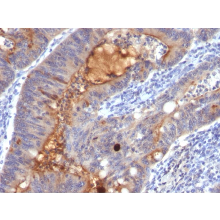 Immunohistochemistry - Anti-ECM1 Antibody [SPM217] (A248386) - Antibodies.com