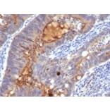 Immunohistochemistry - Anti-ECM1 Antibody [SPM217] (A248386) - Antibodies.com