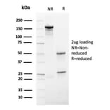 SDS-PAGE - Anti-ECM1 Antibody [SPM217] (A248387) - Antibodies.com