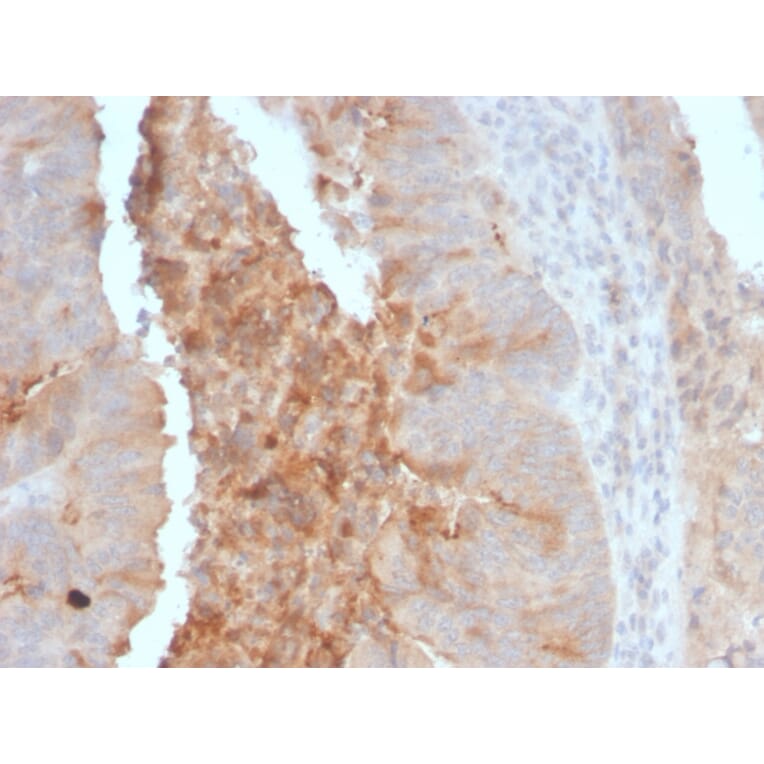 Anti-IgA Secretory Component Antibody [ECM1/792] (A248388)