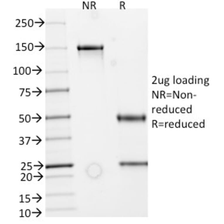 Anti-IgA Secretory Component Antibody [ECM1/792] (A248388)