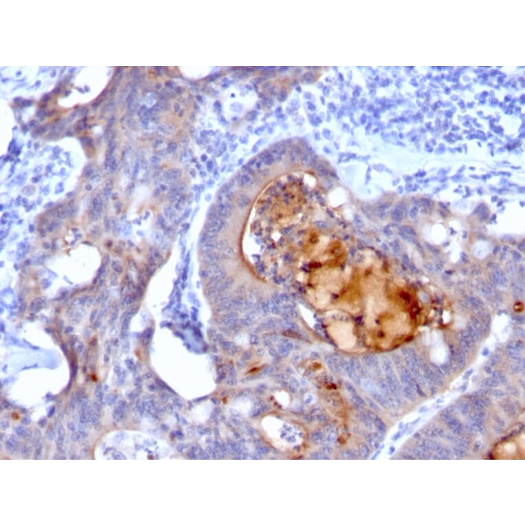 Immunohistochemistry - Anti-ECM1 Antibody [rECM1/792] (A248388) - Antibodies.com