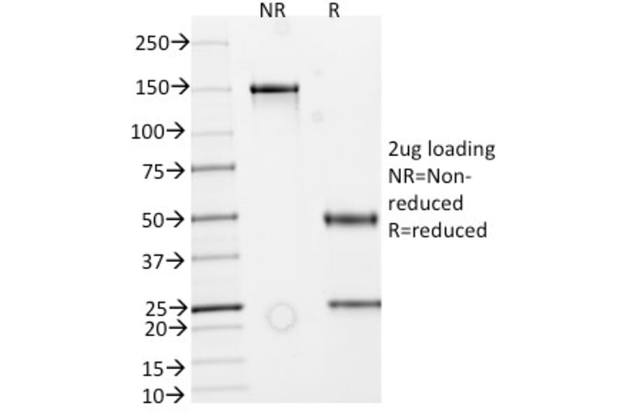 SDS-PAGE - Anti-ECM1 Antibody [rECM1/792] (A248389) - Antibodies.com