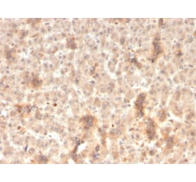 Immunohistochemistry - Anti-ECM1 Antibody [rSPM217] (A248389) - Antibodies.com