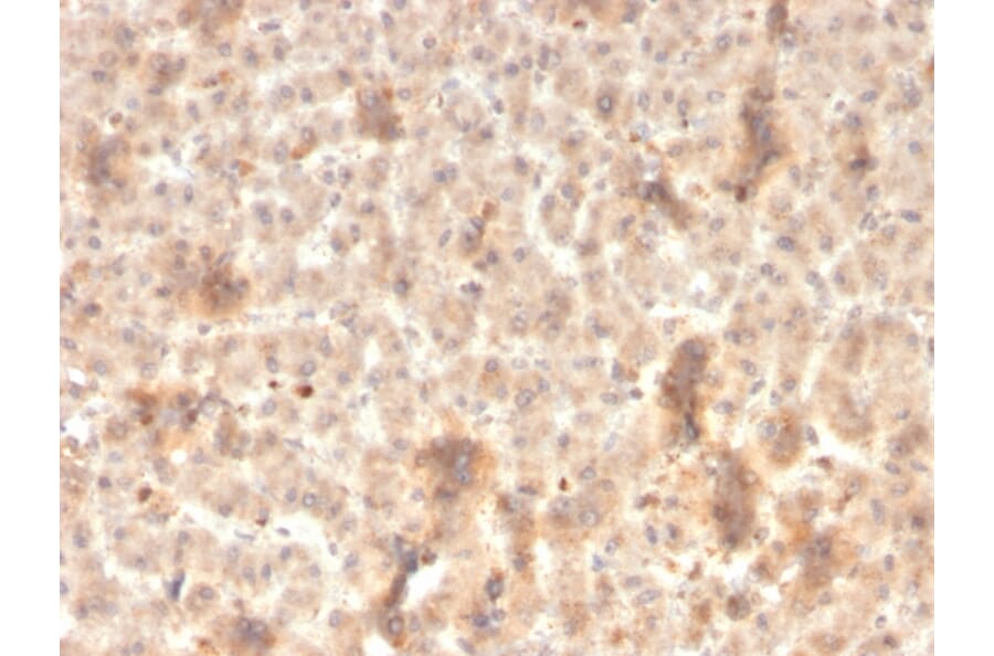 Immunohistochemistry - Anti-ECM1 Antibody [rSPM217] (A248389) - Antibodies.com