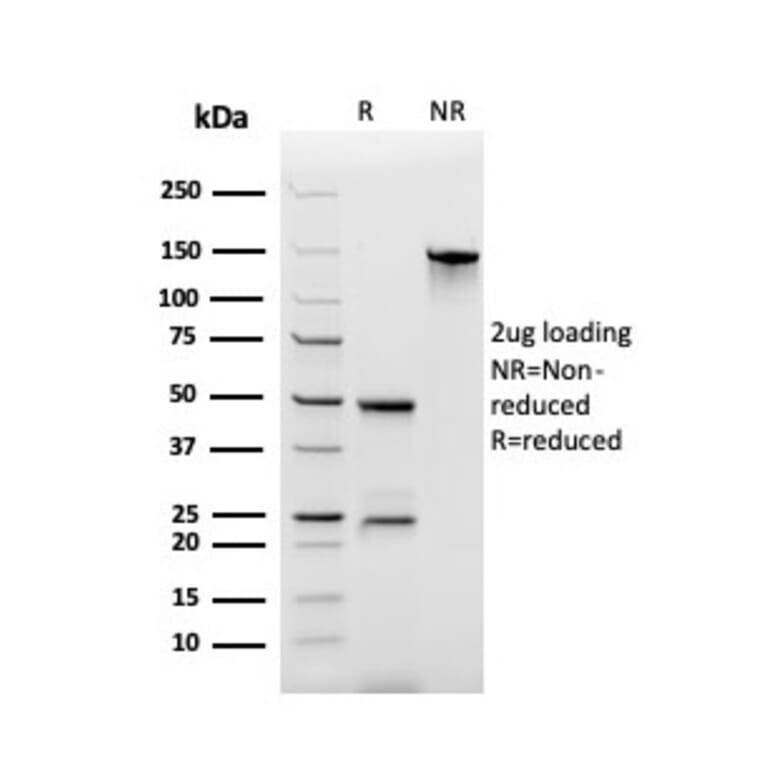 SDS-PAGE - Anti-ECM1 Antibody [rSPM217] (A248390) - Antibodies.com