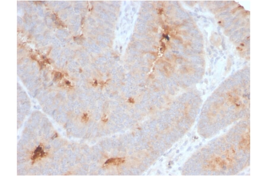 Immunohistochemistry - Anti-ECM1 Antibody [ECM1/2889R] (A248390) - Antibodies.com