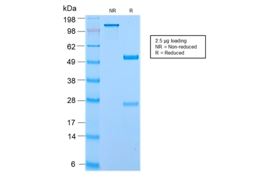 SDS-PAGE - Anti-ECM1 Antibody [ECM1/2889R] (A248391) - Antibodies.com