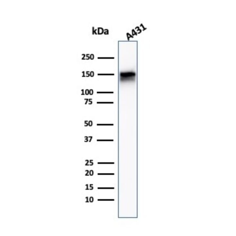 Western Blot - Anti-EGFR Antibody [F4] (A252330) - Antibodies.com