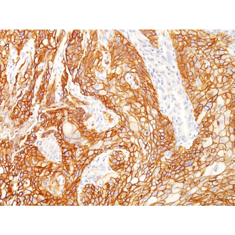 Immunohistochemistry - Anti-EGFR Antibody [GFR/2341] (A248393) - Antibodies.com