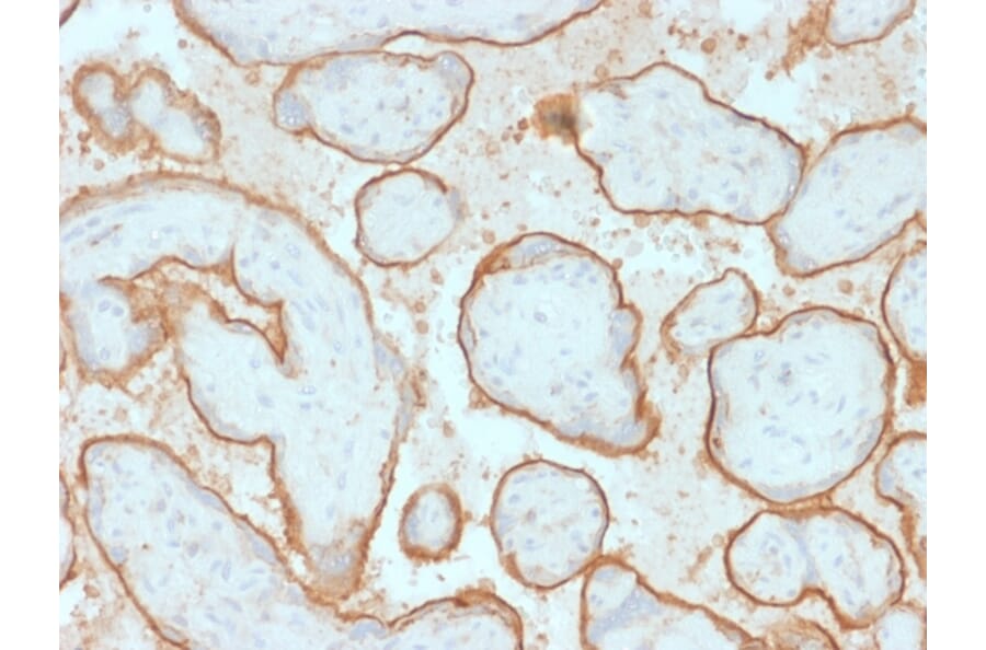 Immunohistochemistry - Anti-EGFR Antibody [GFR/2341] (A248393) - Antibodies.com