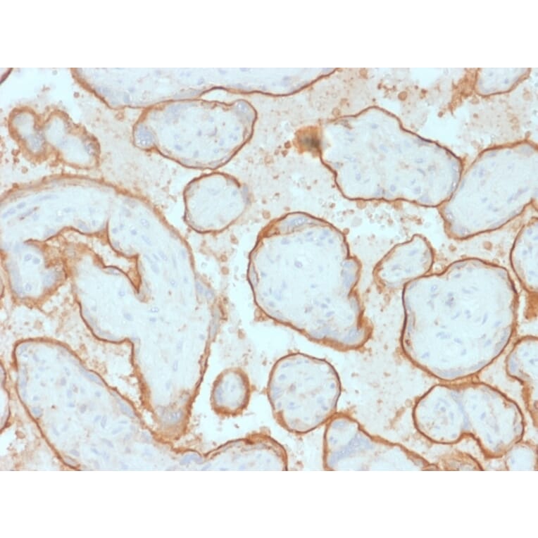 Immunohistochemistry - Anti-EGFR Antibody [GFR/2341] (A248393) - Antibodies.com