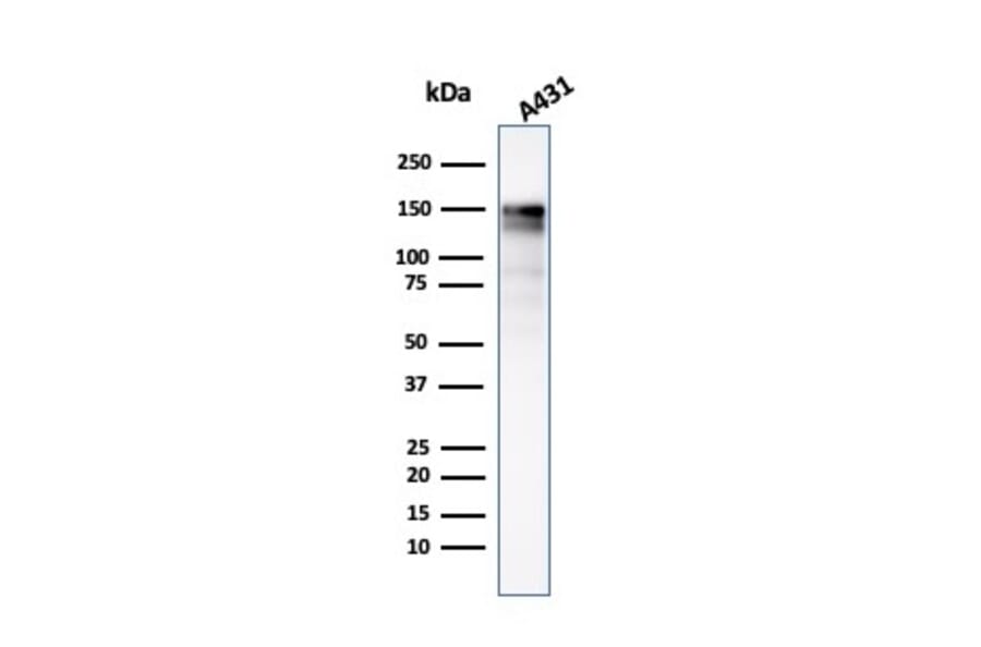 Western Blot - Anti-EGFR Antibody [GFR/2341] (A248393) - Antibodies.com
